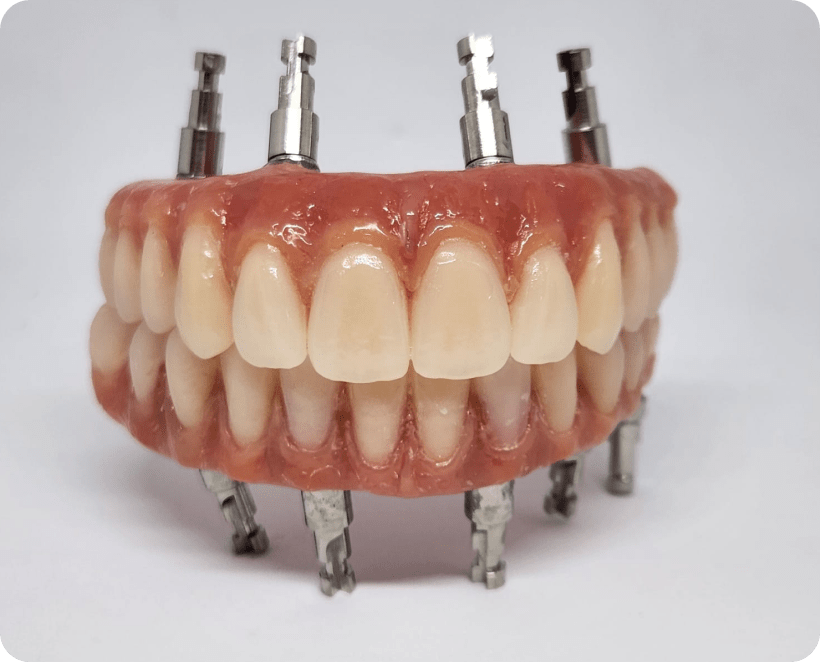 Próteses sobre implantes